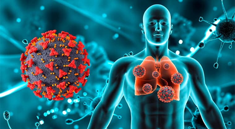 Neumonía y COVID-19